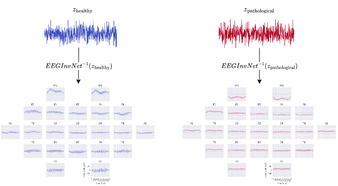 _images/EEGInvNetClassPrototypes.png